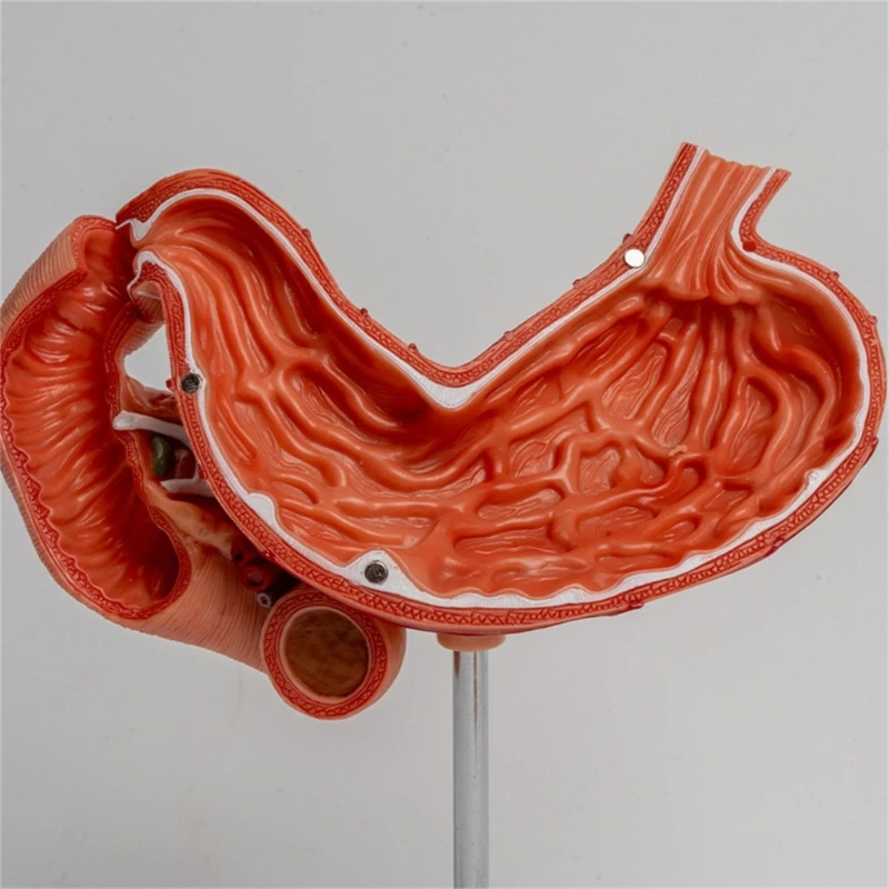 

Anatomical Stomach Model, Duodenum Pancreas Anatomy Model for Diseases Study
