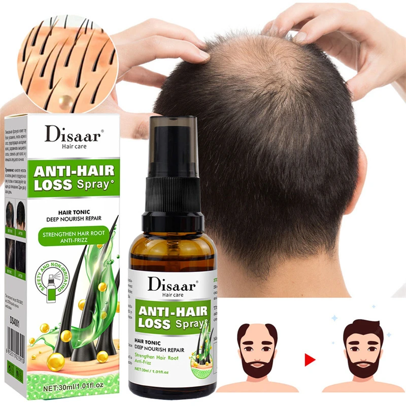 Hair Growth Spray Anti Hair Loss Essence Ginger Strong Moisturizing Nourish  Root Hair Serum Hydrating Repair Scalp Care 30ml| | - AliExpress