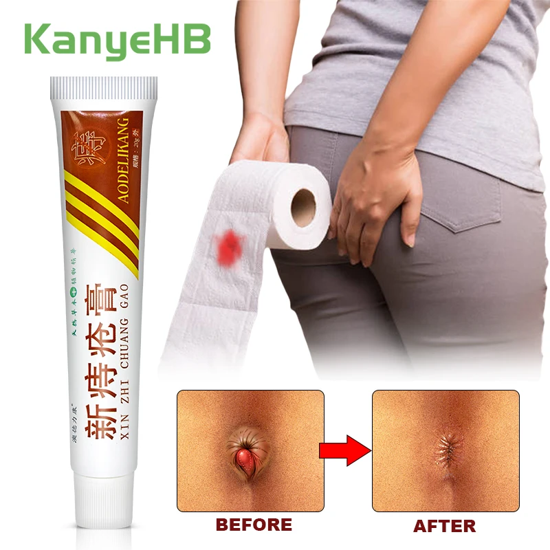 Pain Relief Cream Hemorrhoid Cream Anti-Swelling Repair Antibacterial 1pcs