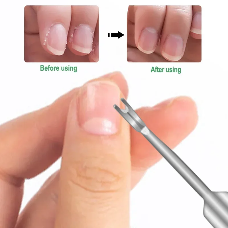 Cuticle Remover Dead Skin Pusher Surgical Grade Stainless Steel Nail Art Manicure Tools Scraper Nail Cleaner Trimmer For Nail Art Pusher Manicure Tools Nail Manicure Tools Manicure Pedicure Tools Cuticle Pusher Dead Skin Remover