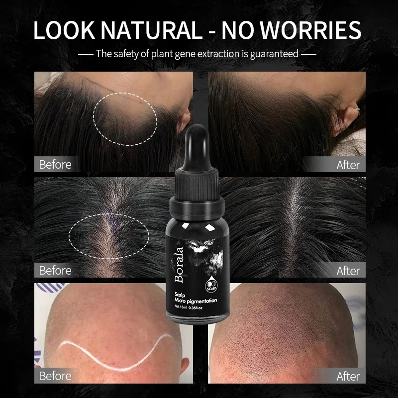 Tattoo Ink Tattoo Ink Pigment BORALA Scalp Micropigmentation Permanent Makeup Professional Microblading Pigments for Hairline SMP Tattoo Inks Supplies