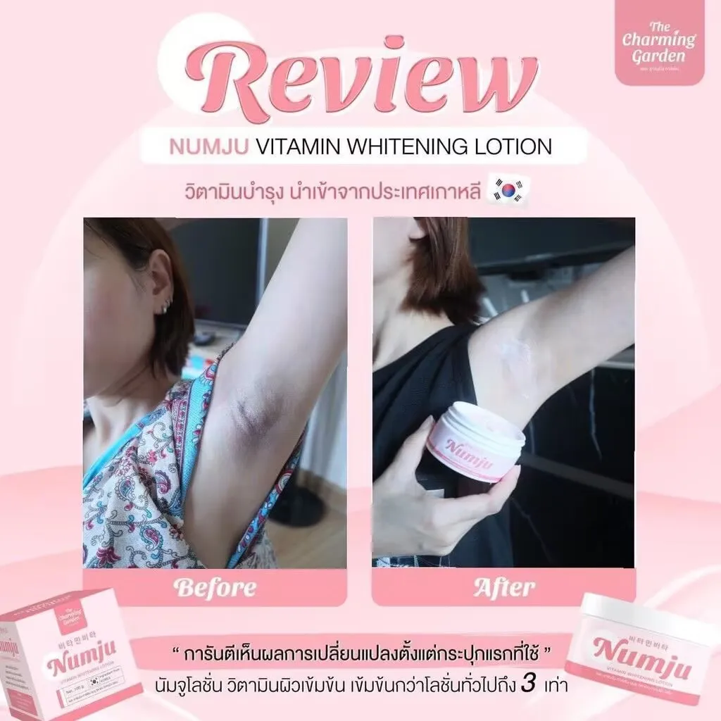 Numju-loci&oacute;n blanqueadora con vitamina, Reduce la oscuridad, axila, codos, rodillas, gl&uacute;teos, estr&iacute;as, piel blanca suave, 100 g