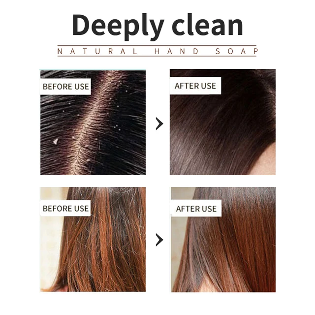 Lavender shampoo is refreshing, oil controlling, and smooth for hair, solving the problem of oily scalp without silicone oil res 4
