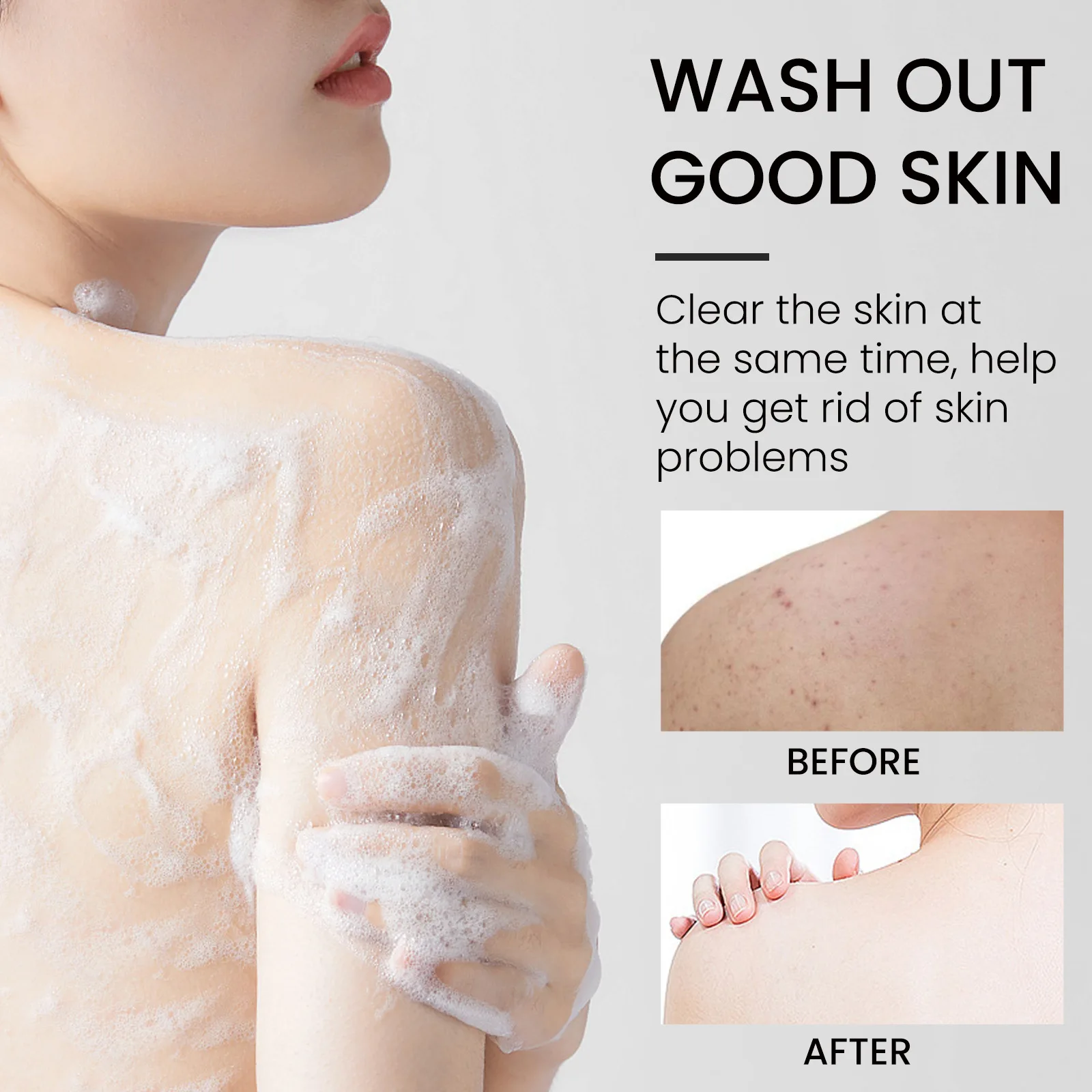 Рисунок 4 - Увлажняющее Отбеливающее мыло для лечения псориаза