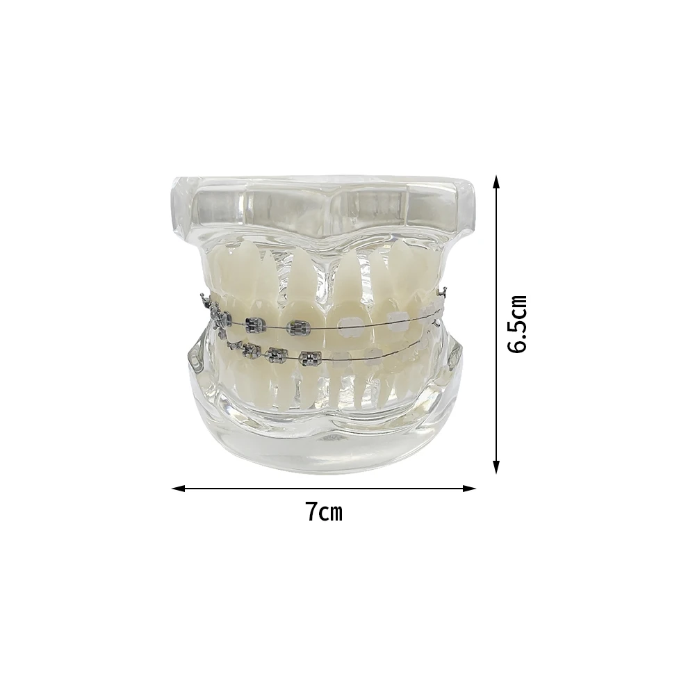 치과 교정 모형 타이포돈트 반금속 반세라믹 교정 치아 모형 학습 교육 환자 교육용