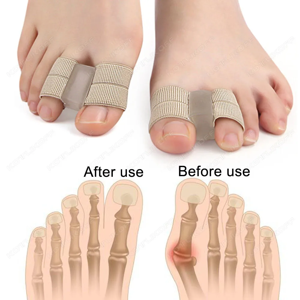 Silikon-Zehenspreizer, Hallux Valgus Bunion Corrector, Orthesen, Füße, Knochen, Daumen, Einsteller, Korrektur, Pediküre, Fußglätter – Detail 7
