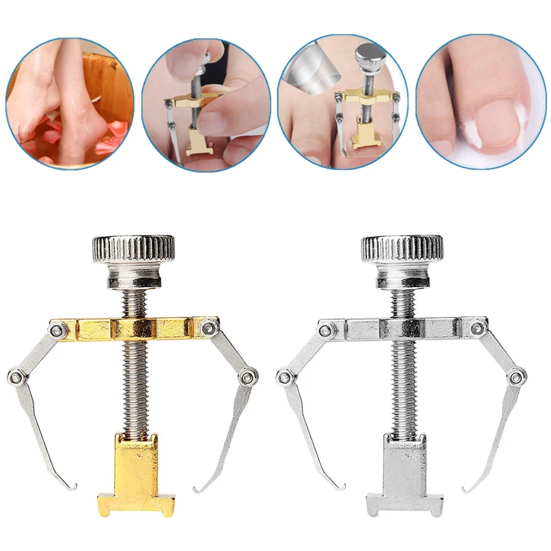 

Ingrown Toenails Corrector Stainless Steel Nail Straightening Tool Relief Pain Pedicure Tool For Ingrown Toenail Recover