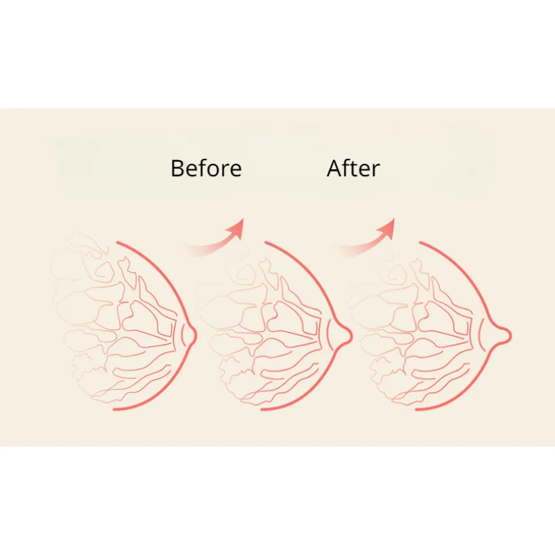 Nipple clips Nipple Clamps Retraction Pump Sucker Teat Massager Corrector Nipple Sucker BDSM Toy Breast Stimulator Sex toys for Woman Man