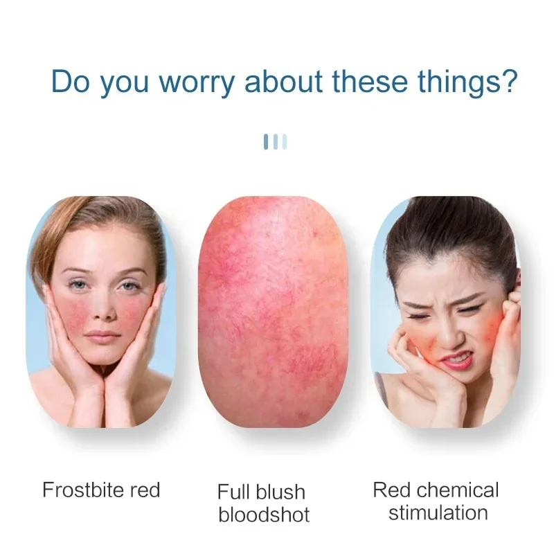 High Frequency Needle RF Spider Veins Removal Anti Redness Machine Red Blood Vessel and Spots Vascular Removal Beauty Equipment