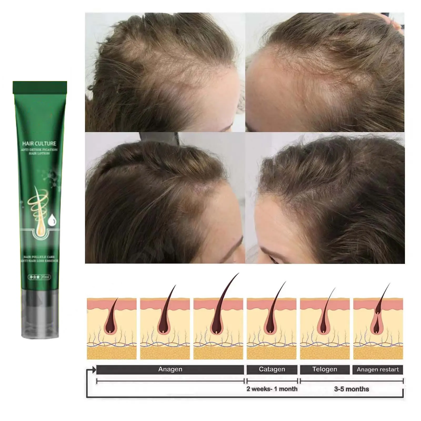 Description Picture 5 of itemHair Growth Oil Fast Hair Growth Effective Baldness Repair Hereditary Hair Loss Postpartum Hair Loss Seborrheic Hair Loss