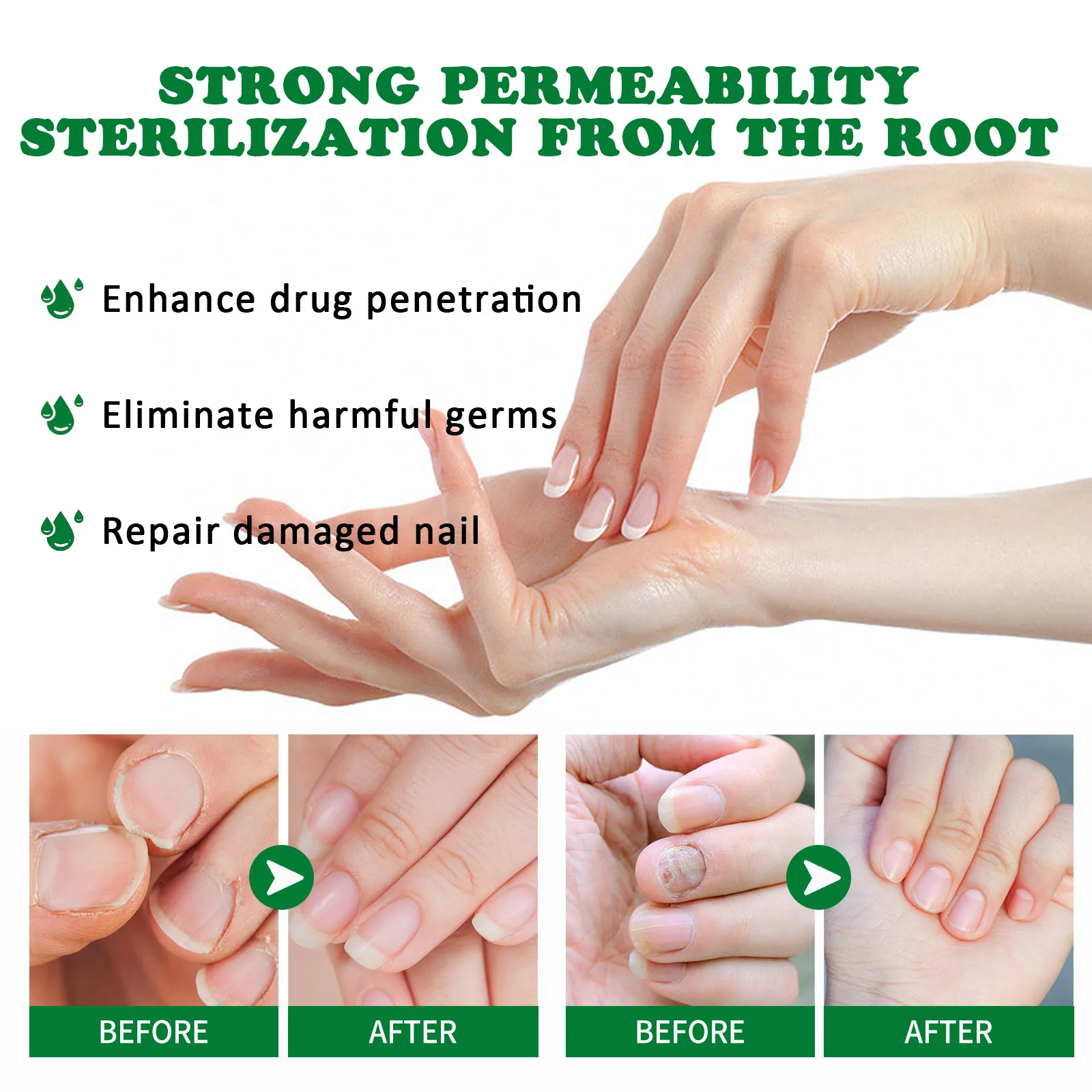 Nail Fungus Remover Personal Health Care Manicure Pedicure Tools Nail Fungal Treatment Device 1-5Pcs