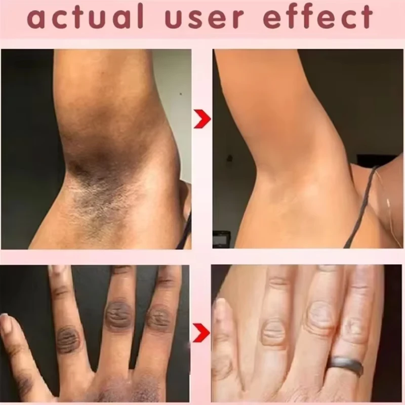 Body Whitening Soap Deep Clean Skin Chicken Skin Removal Soap Armpit Underarm Knees Bleaching Body Brighten White Care Products 4 Body Whitening Soap Deep Clean Skin Chicken Skin Removal Soap Armpit Underarm Knees Bleaching Body Brighten White Care Products 4