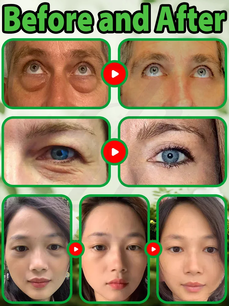 Lifting eye cream unlock eye firmness and regain youthful confidence
