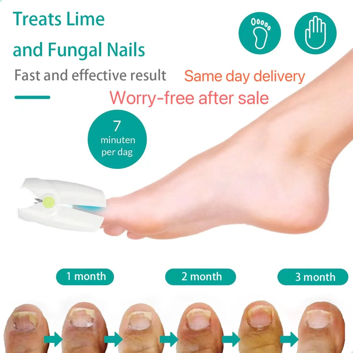 Fungal Nail Infection Causes, Symptoms and Treatment