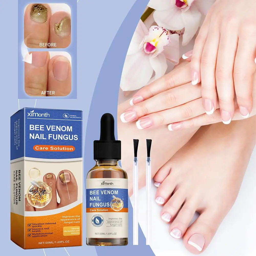 Nail Repairing Liquid Fungus Treatment Essence Care Fungal Gel Paronychia Anti-infective Foot Removal Hand Repair M7C3 50ml
