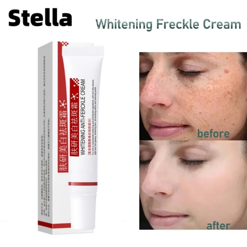 Whitening Freckles Cream Face Skin Care Lighten Dark Spots Repair Remove Melasma Dark Spots Lighten Remover Moisturizing 20ml face skin care whitening freckles cream remove melasma dark spots lighten remover moisturizing brightening 20ml