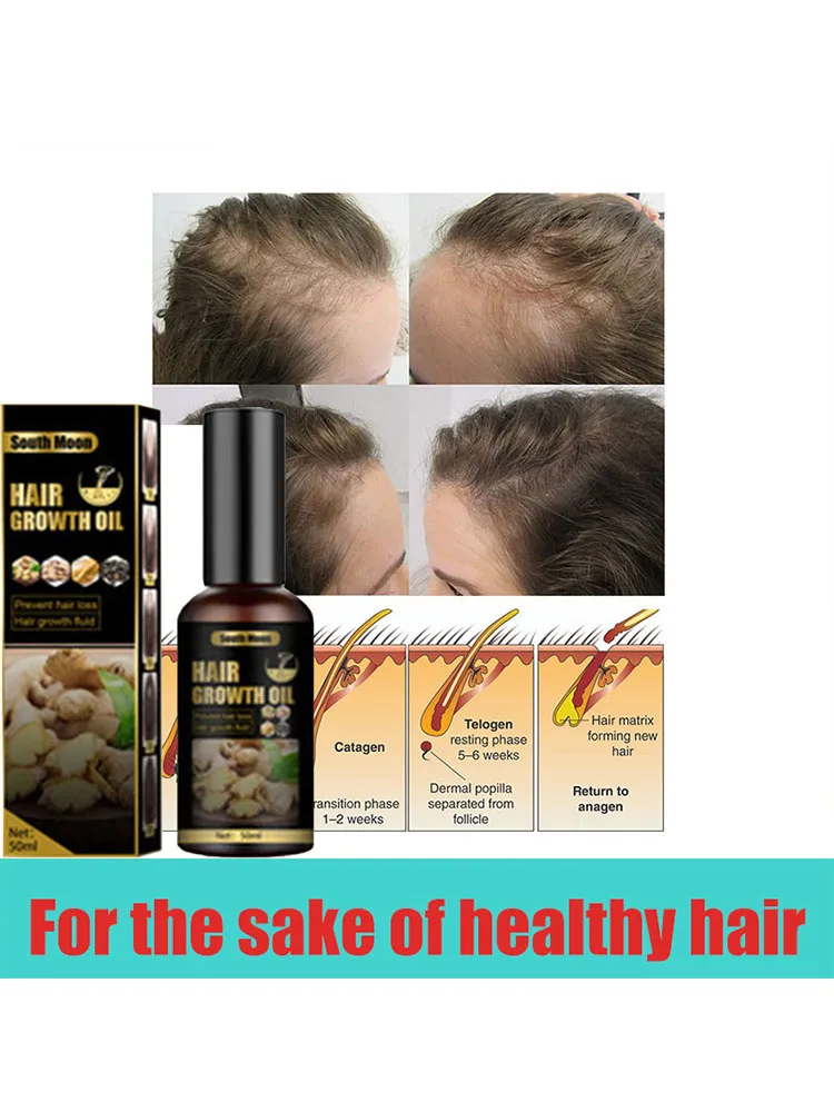

Protect your hair. Anti hair loss spray anti hair loss hair nutrition growth agent essence promotes hair growth