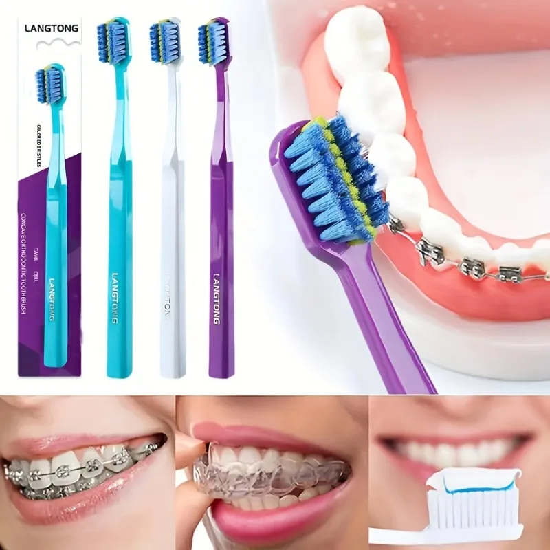 1개입 교정용 칫솔 오목 홈 디자인 컬러 브러쉬로 치아 교정기 세척 및 구강 관리에 적합
