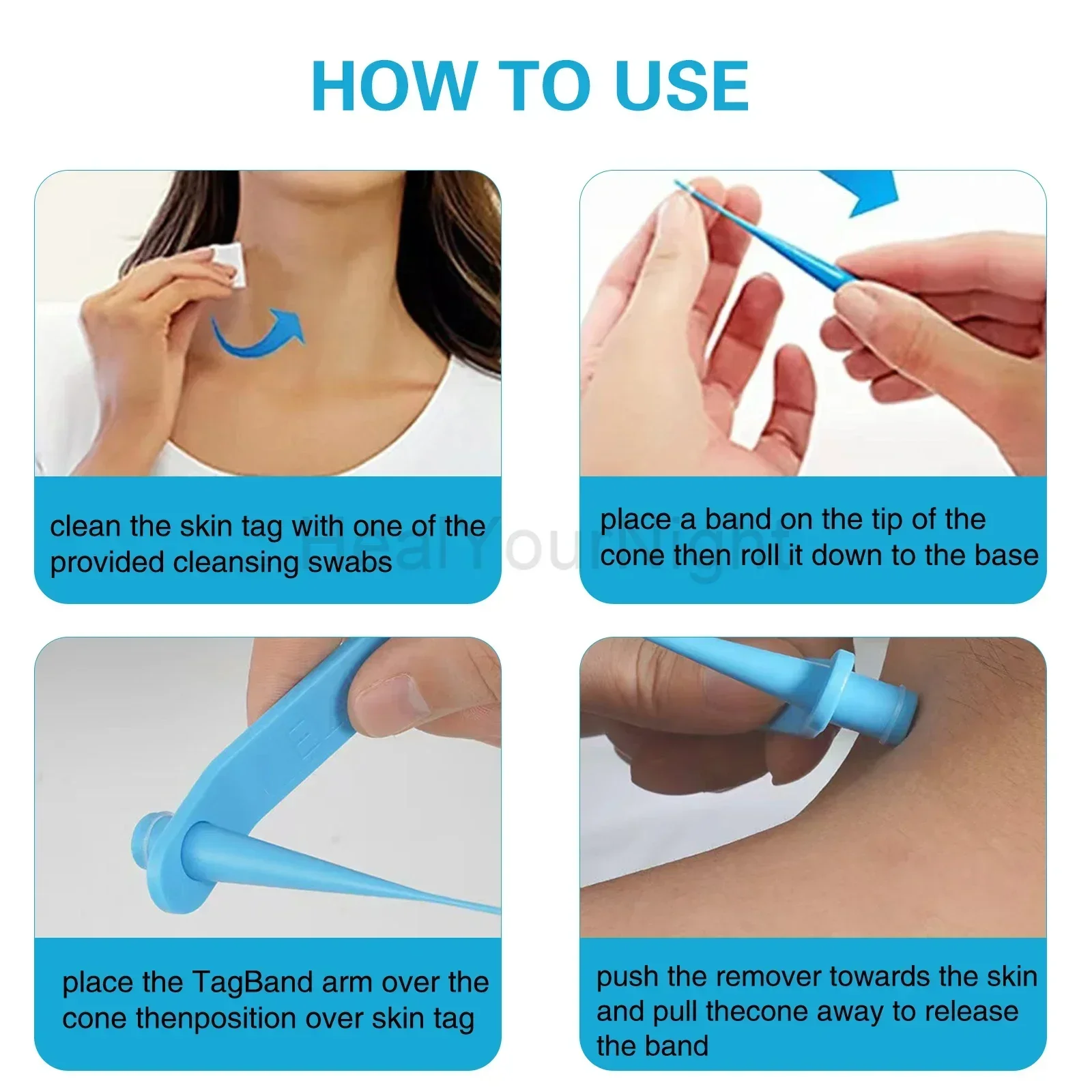 3-IN-1 Auto Skin Tag Removal Kit Painless Skin Label Mole Acne Wart Removal Pen Set with Cleansing Swabs Facial Beauty Care Tool 3