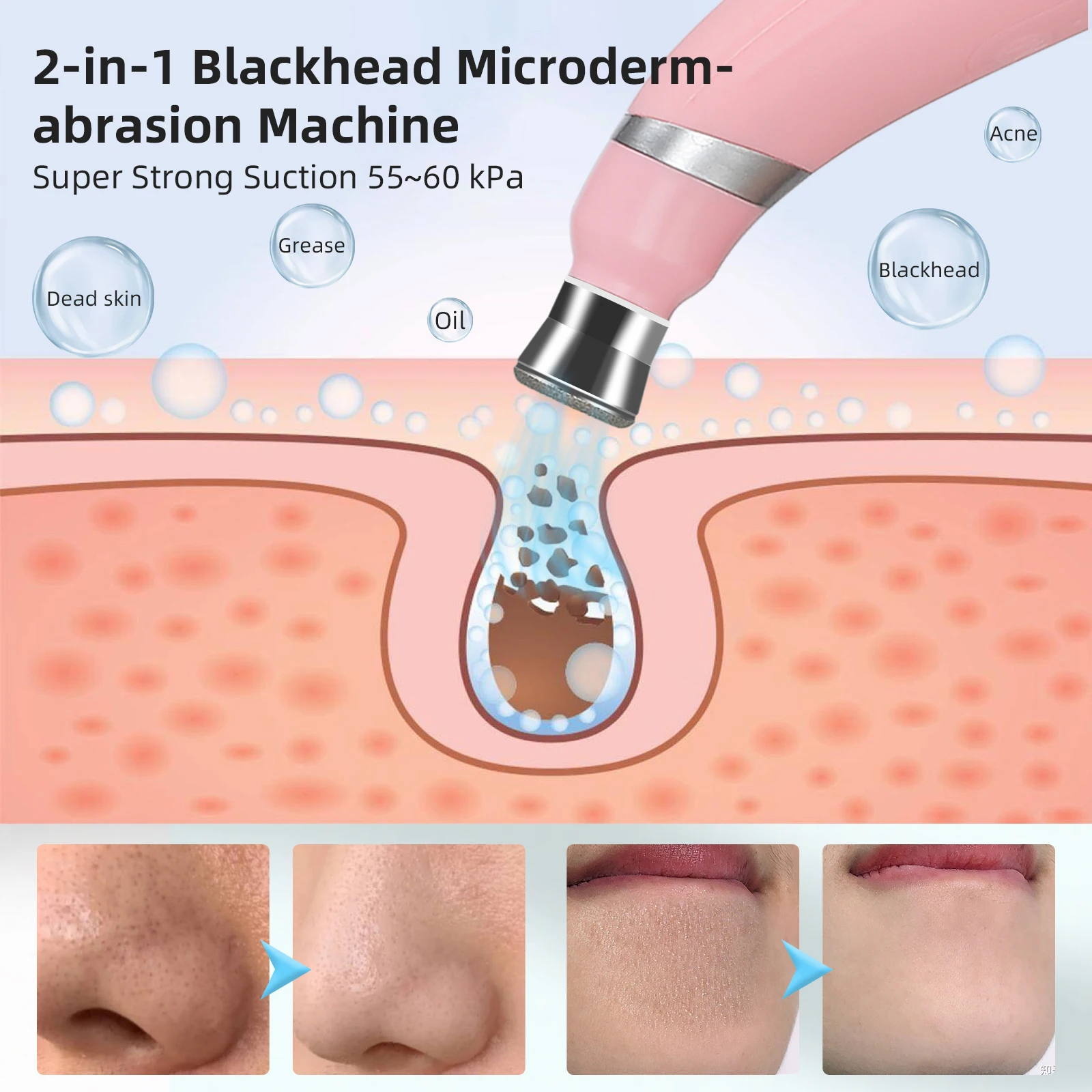 Portable Diamond Microdermabrasion Machine Facial Peeling Device Exfoliation Vacuum Blackhead Remover With 4 Diamond Peeling Tip 4