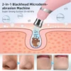 Portable Diamond Microdermabrasion Machine Facial Peeling Device Exfoliation Vacuum Blackhead Remover With 4 Diamond Peeling Tip 4