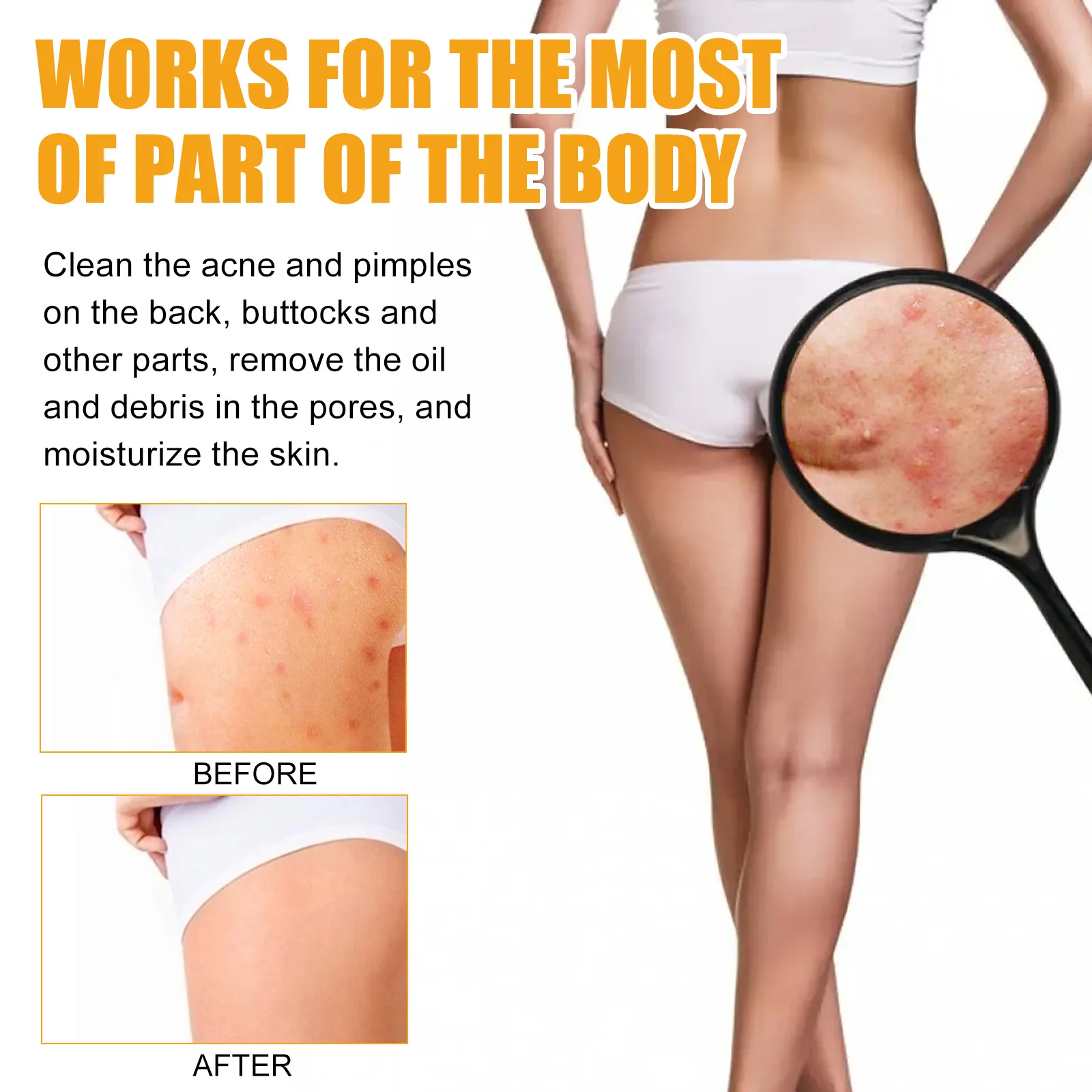 Рисунок 6 - Сыворотка для лечения акне для тела