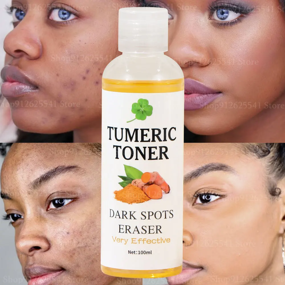 

100ml Dark Spots Eraser Turmeric Toner Natural Tumeric Facial Strong Lightening Toner for Black Skin Tone Flawless Skin Care
