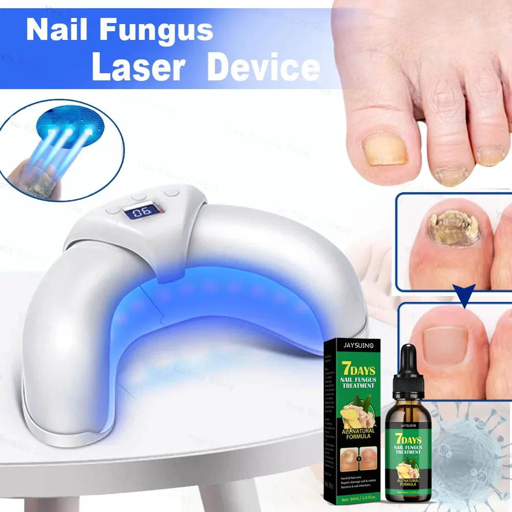 Fungal Nail Laser Treatment Repair Fast Nails Fungus Onychomycosis