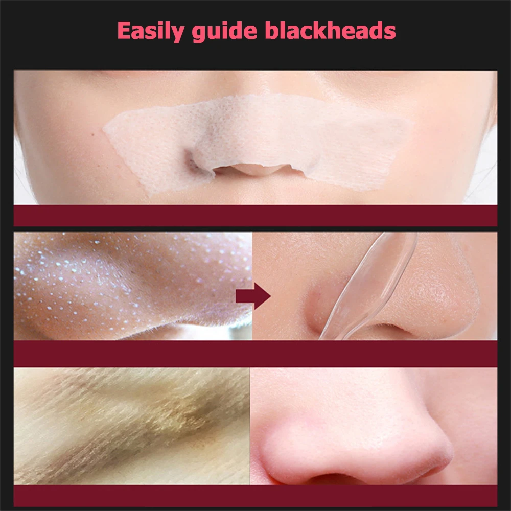 Blackhead Exporting Liquid With Small Bubble Device for Deep Cleansing Blackhead Acne Removal Shrinkage Pore