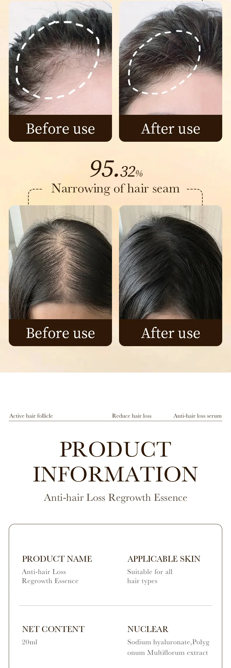 Hair Growth Products Fast Growing Hair Massage Essential Oil Natural Anti Hair Loss Prevent Hair Dry Frizzy Damaged_voghion.com