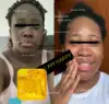LIGHTENING Skin Soap, Face & Body Wash, Deep Skin Cleanser, ACTIVE & EFFECTIVE 1