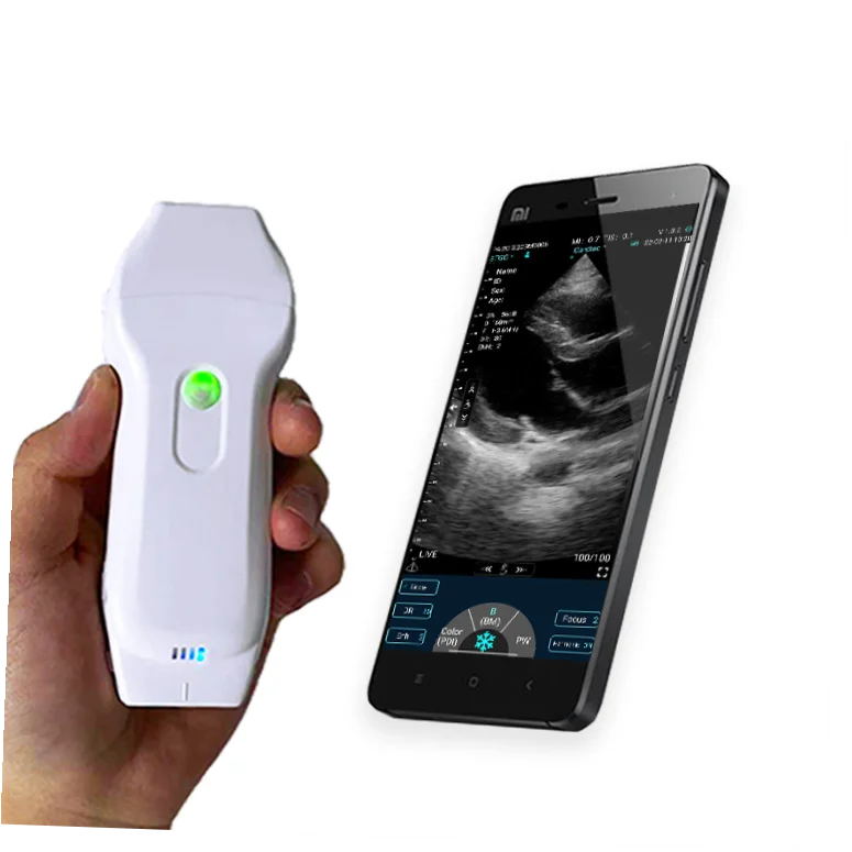 Konted Handheld Wifi Wireless Mobile Ultrasound Probe Scanner Device  Supplier