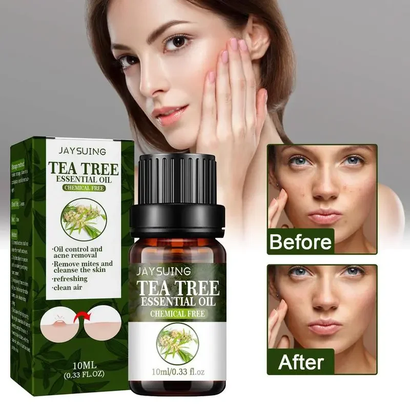 

Pure Tea Tree Oil 100 Natural Tree Tea Oil Drops Activate Skin Cells Pore Shrinkage Essential Oils For Aromatherapy Diffuser