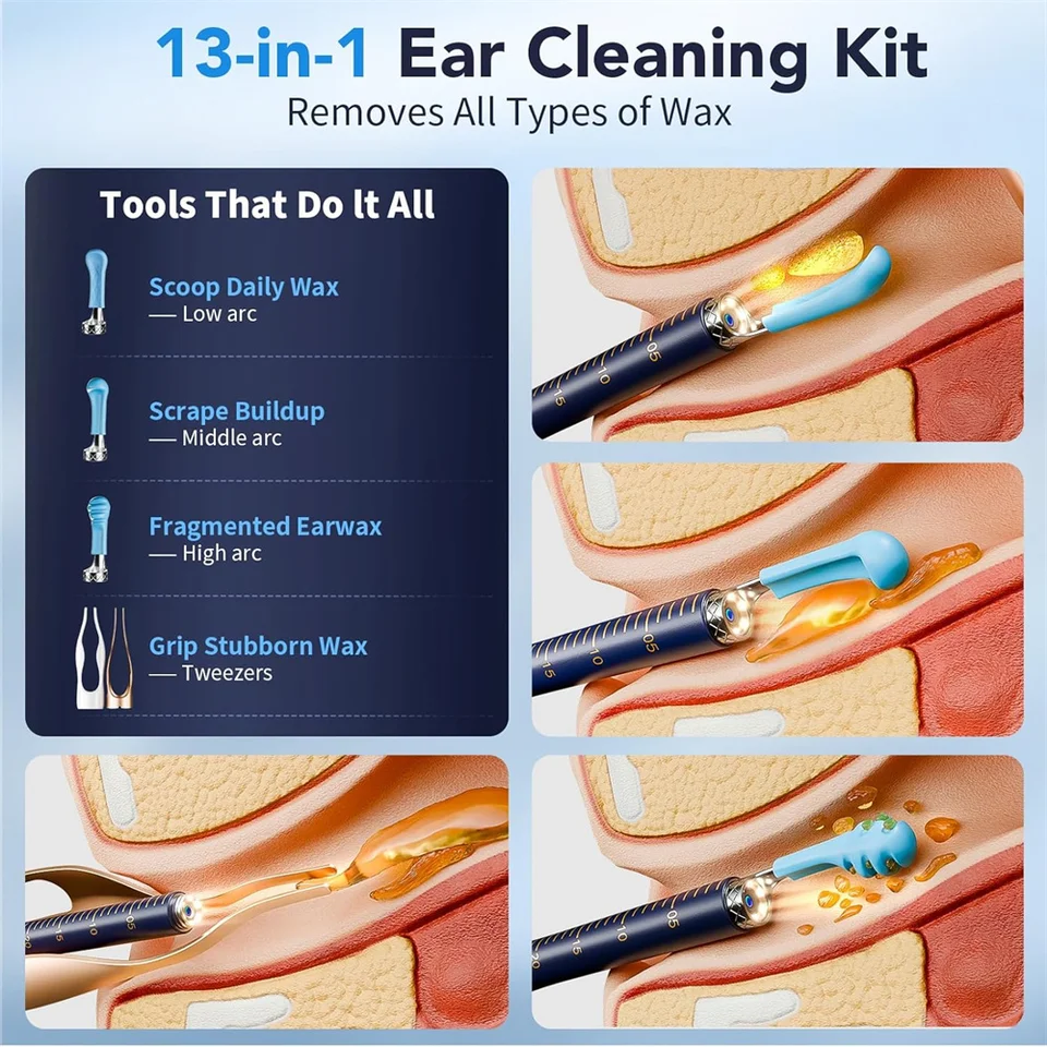 Wax Removal Tool Camera 1000W Pixels Visible Cleaner Kit Tweezers Ear Cleaning With Light Earpick For Adults_voghion.com