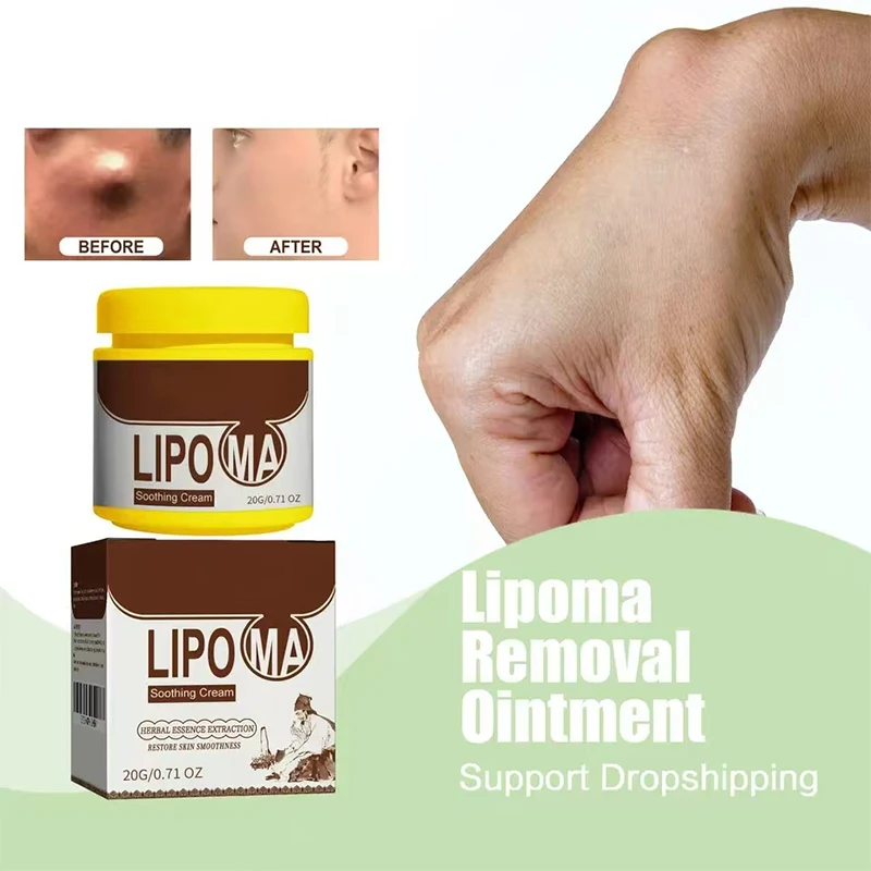 Treatment Lipoma Cream Subcutaneous Lumps Remover Medicine Liquid Apply To Skin Swelling Cellulite Fibroma Fat Mass Plaster