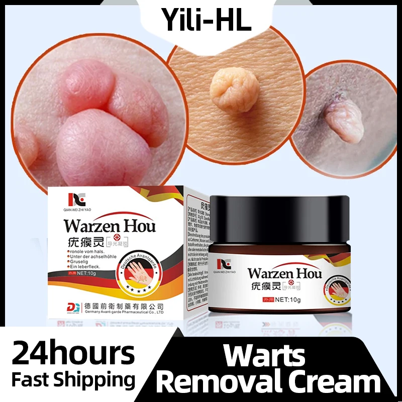 

Wart Remover Cream Mole Corns Ointment Flat Warts Calluses Treatment Skin Tag Removal Medicine German Secret Recipe