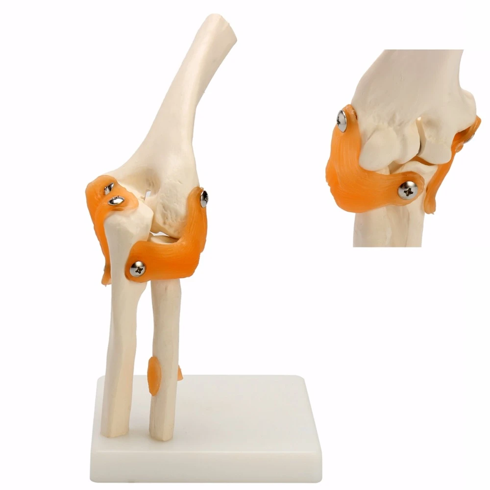 Cartoon Model Human Elbow Joint Model Anatomical Anatomy Elbow Joint  Medical Model Orthopedics - Medical Science - AliExpress