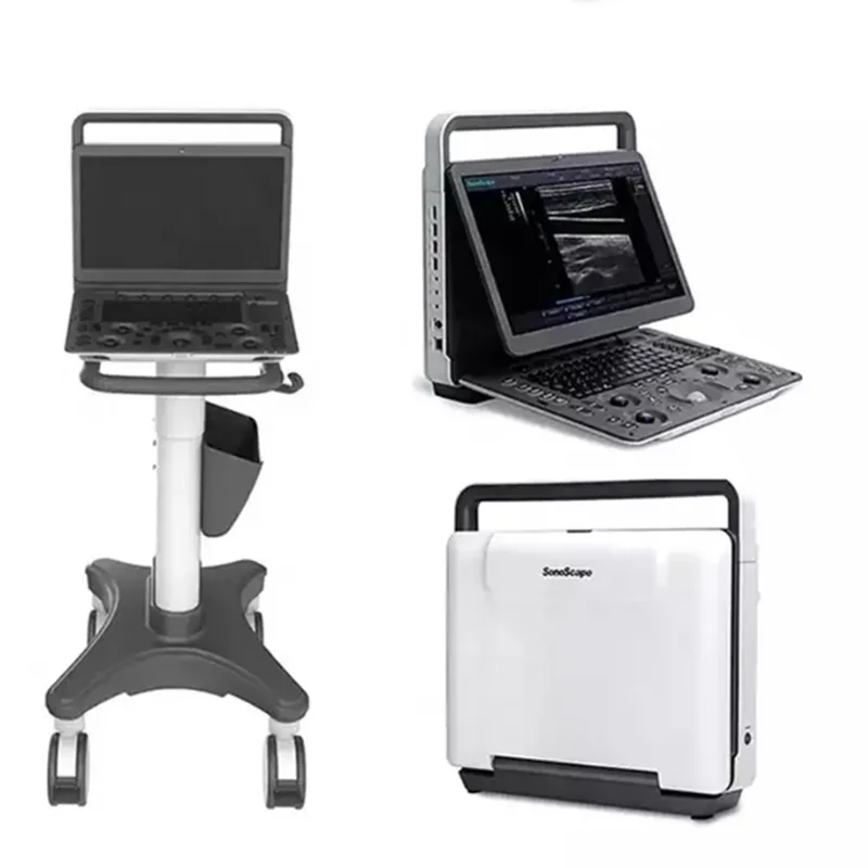 Prodotti Soggetti A Negazionisonoscape 2D/3D E1/E2 /E2 Pro/E3 Ultimo Popolare Ecografo Color Doppler Portatile Ob Gyn Laptop