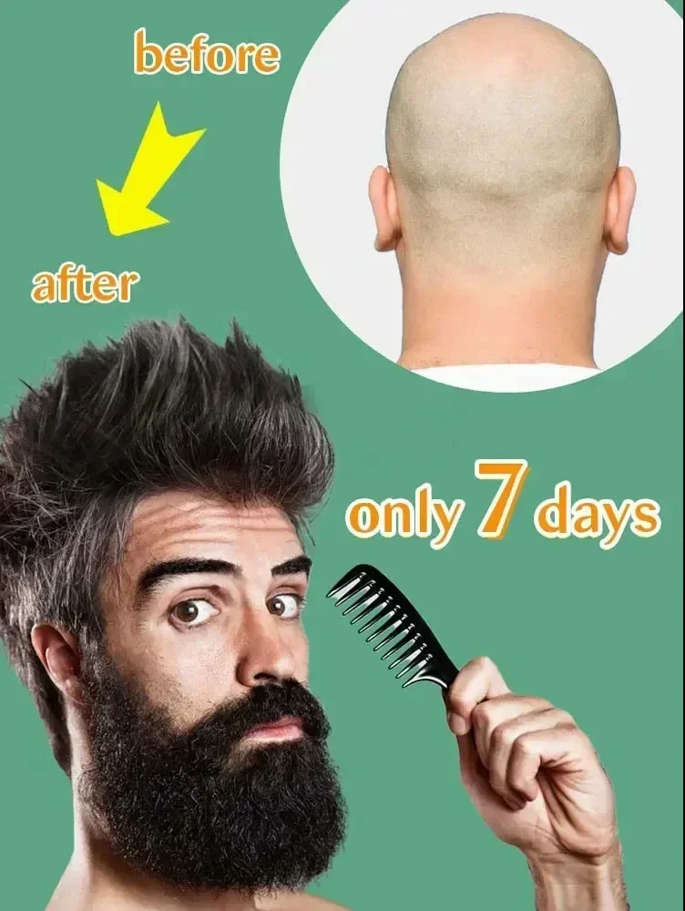 Successful products, 99% of buyers will buy again, they have more and more hair, say alpha baldness, thick hair