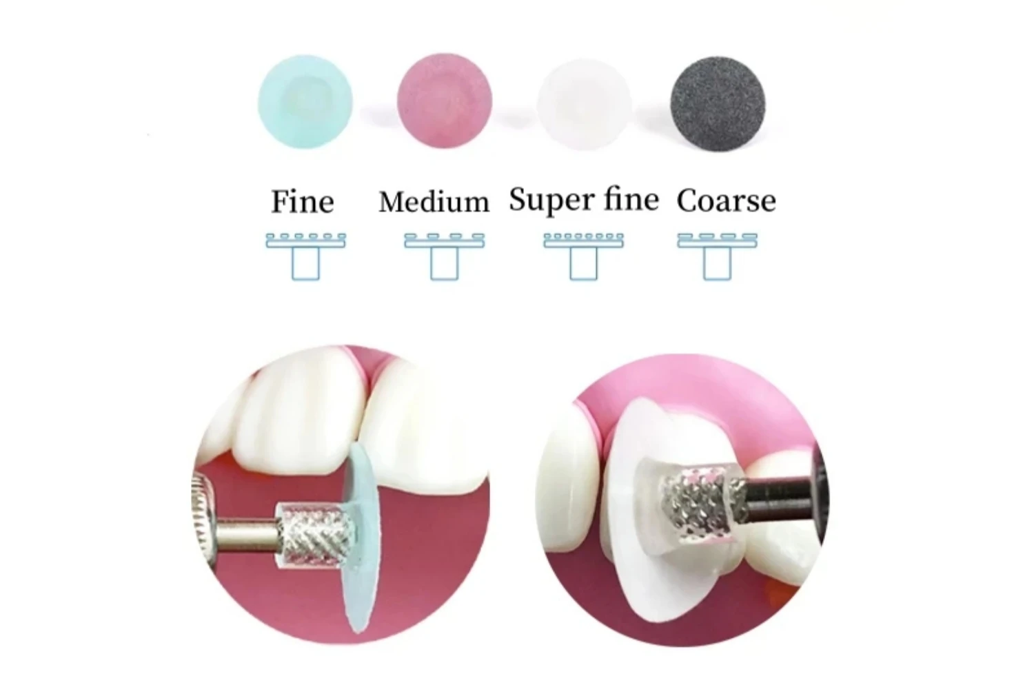 40 stücke Dental Polieren Scheiben Verbund Finishing Polieren Stem Disc Kit Reduktion Konturierung Dorn Zähne Bleaching Materialien – Detail 8
