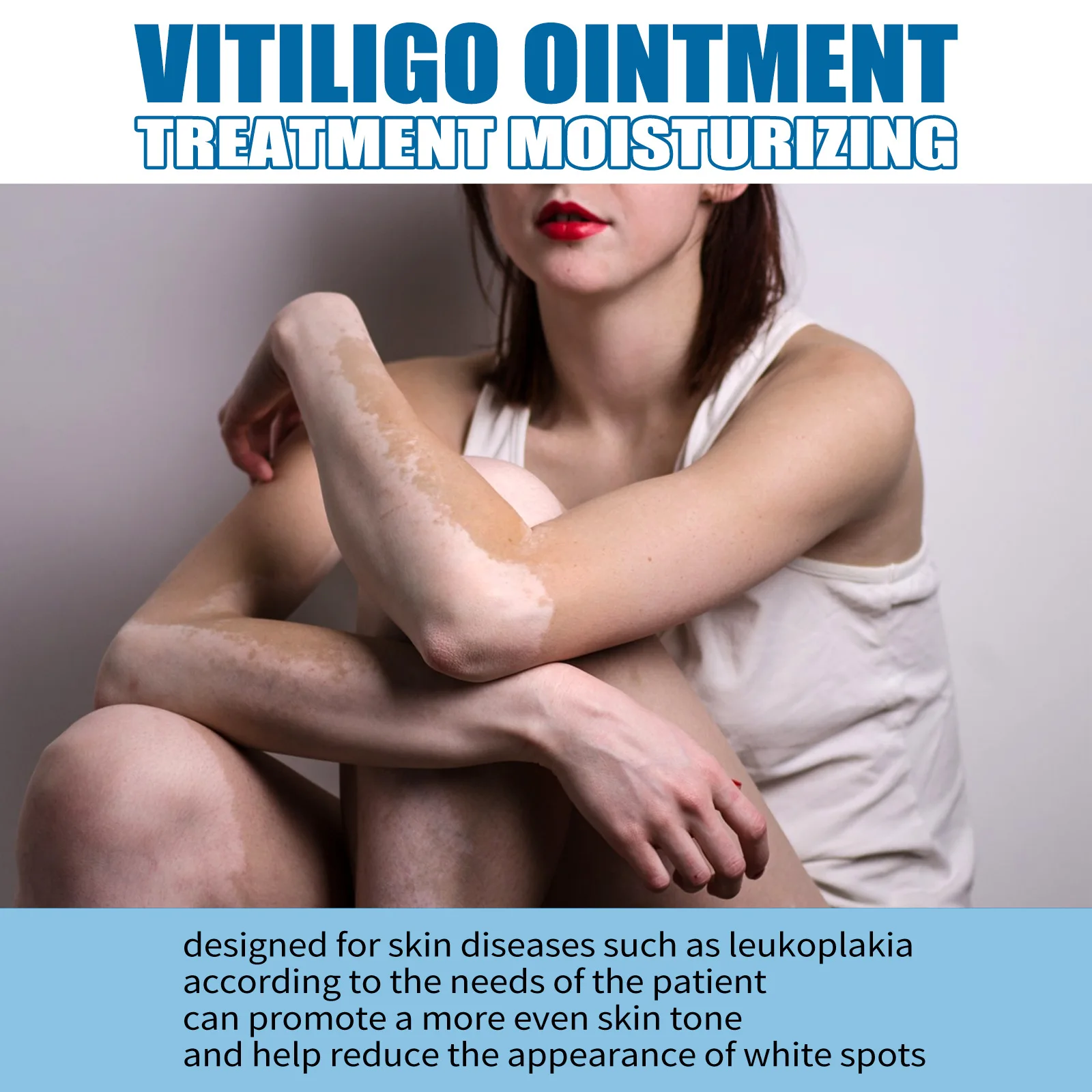 South Moon Vitiligo Treatment Ointment Antibacterial Remove White Spot Ringworm Skin Leukoplakia Disease Dermatitis Cream 20ml
