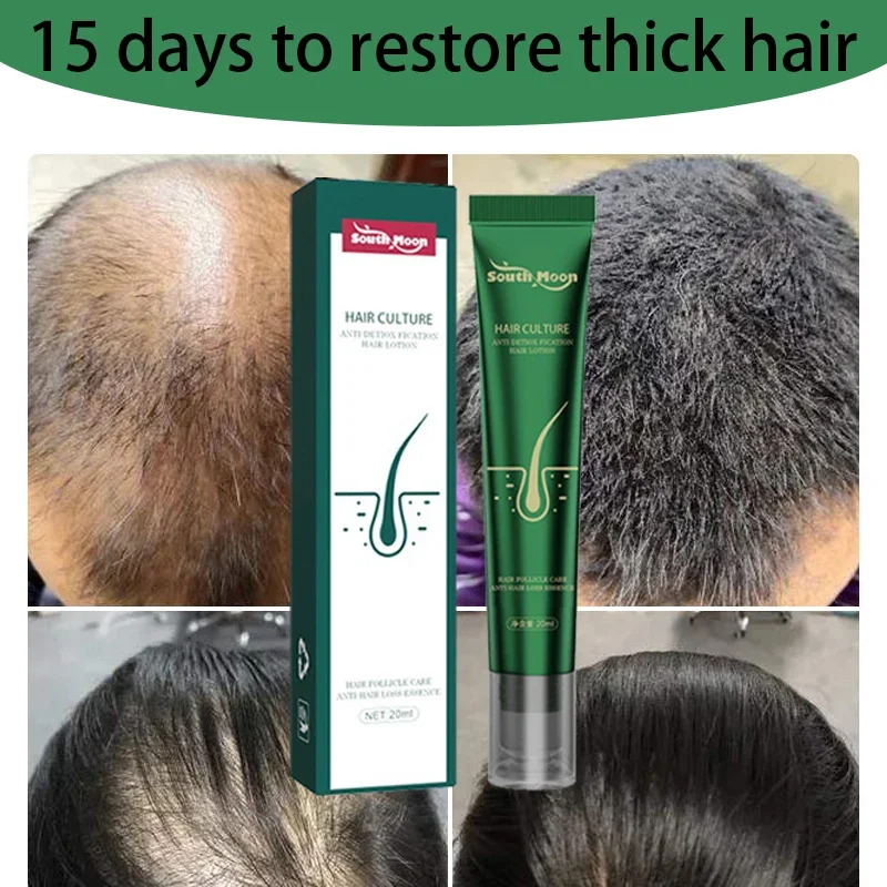 

Strong Effect Hair Growth Products Ginger Essential Oil 2 Week Treat Hair Loss Scalp Repair Nourish Hair Roots Regrowth