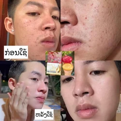 Thai BokTor Facial Cleanser Soap For Whitening And Removing Spots, Acne, Melanin, Brighten white, Moisturizing luster Skin 90g