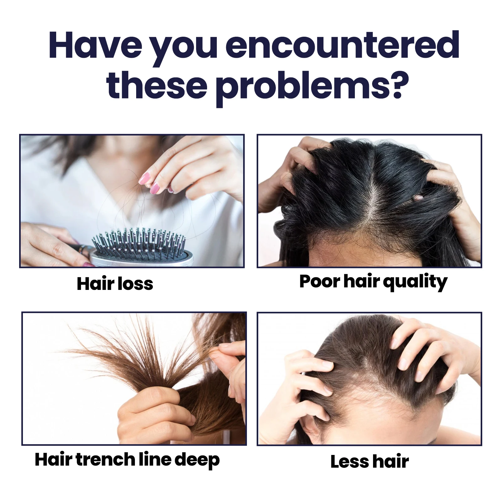 OUHOE Hair Growth Spray Designed To Strengthen Stop Hair Loss Natural Essence Repair & Strengthen Follicles Spray