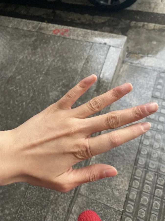 thumb