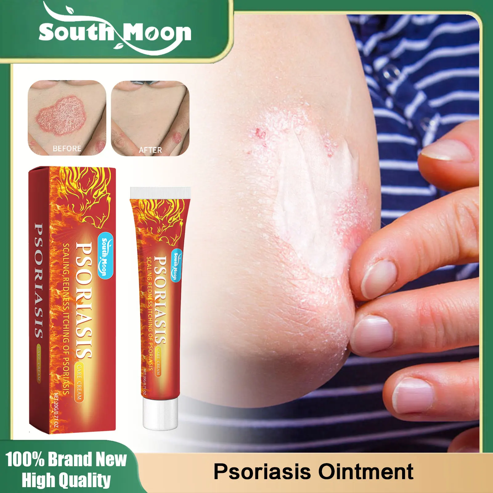 Herbal Psoriasis Ointment Eczematoid Skin Antipruritic Repair Cream Dermatitis Urticaria Rash Antibacterial Disinfect Skin Care