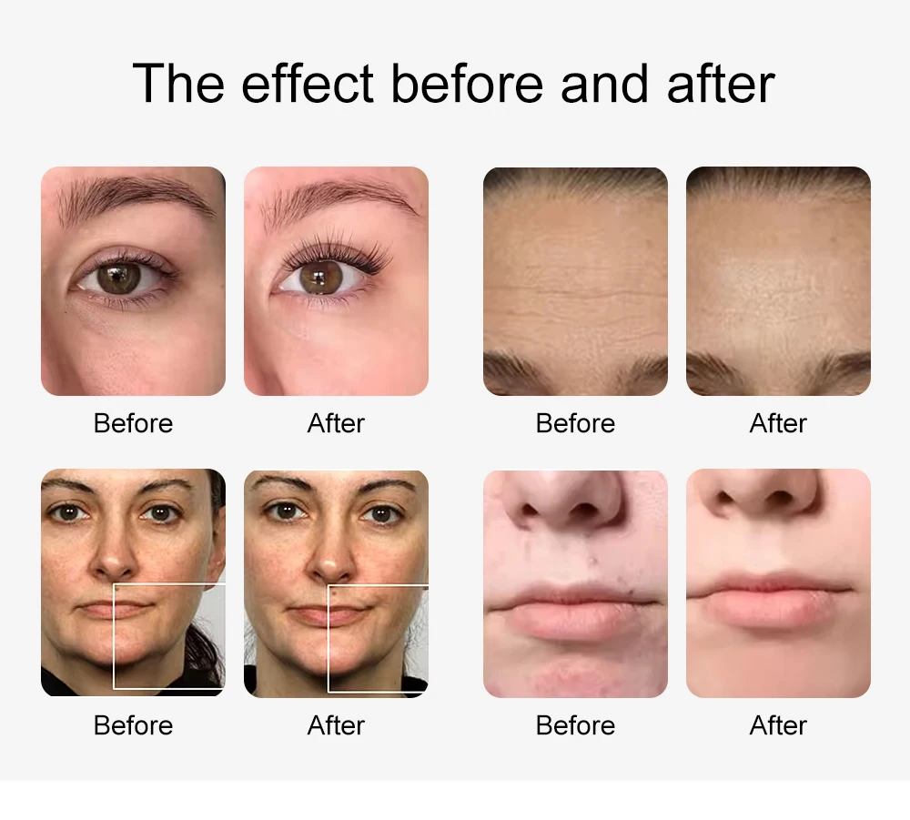 12 in 1 Water Oxygen Hydro Machine Face Lifting Deep Cleaning Dermabrasion Aqua Peeling Machine Skin Rejuvenation Small Bubble