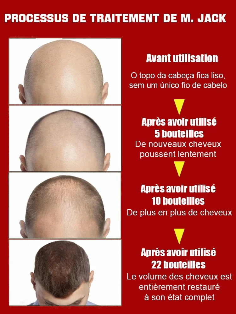 Hair Growth Product Have more and more hair say goodbye to baldness thick hair