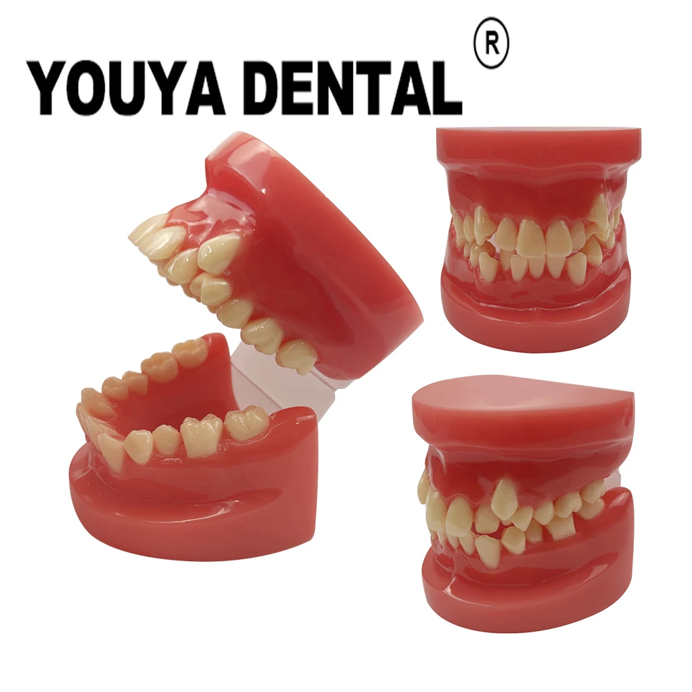 

Dental Malocclusion Tooth Model Teeth Teaching Model for Dentist Students Practice Studying Doctor-patient Communication Tools