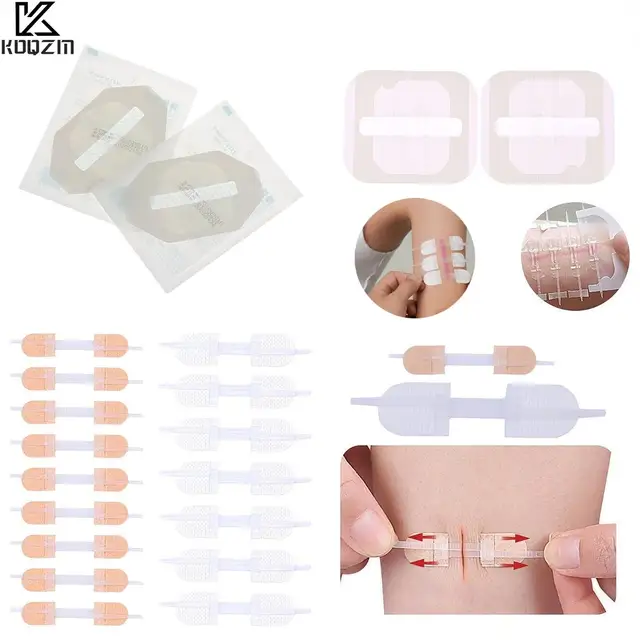 휴대용 반창고 지퍼 타이 상처 봉합 패치, 지혈 패치, 빠른 봉합, 야외 밴드 보조